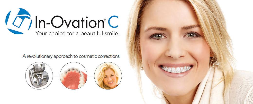 In-Ovation C, Your choice for a beautiful smile. Clear Braces Image