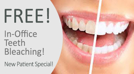 Free Teeth Bleaching Special